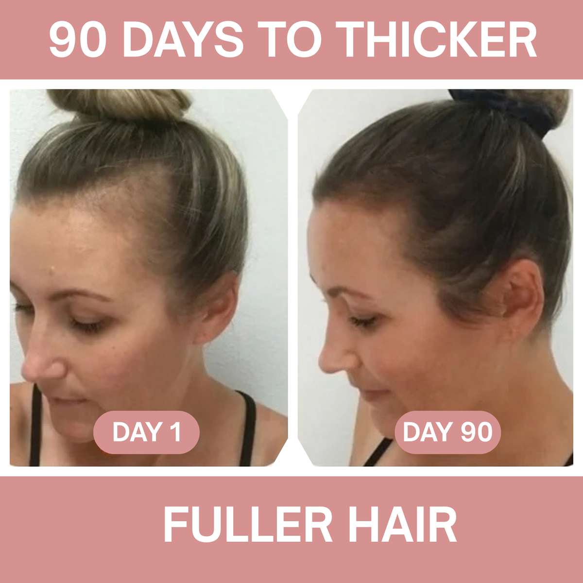 Bio Lim Hair Helper™